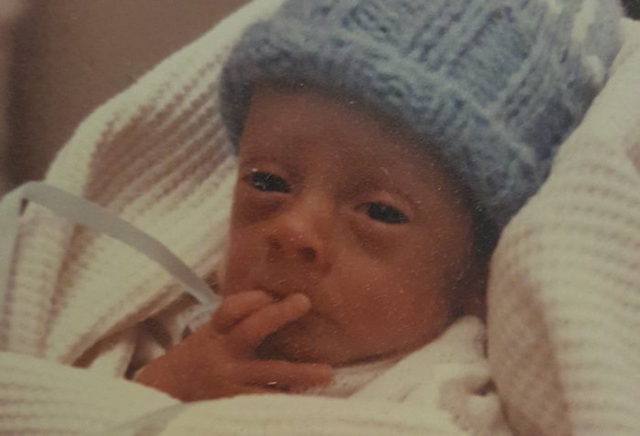 premature baby with blue cap