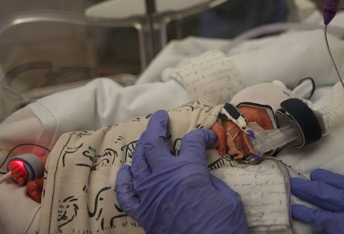 Newborn baby on NAVA