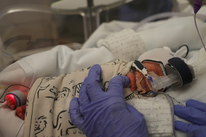 Newborn baby on NAVA