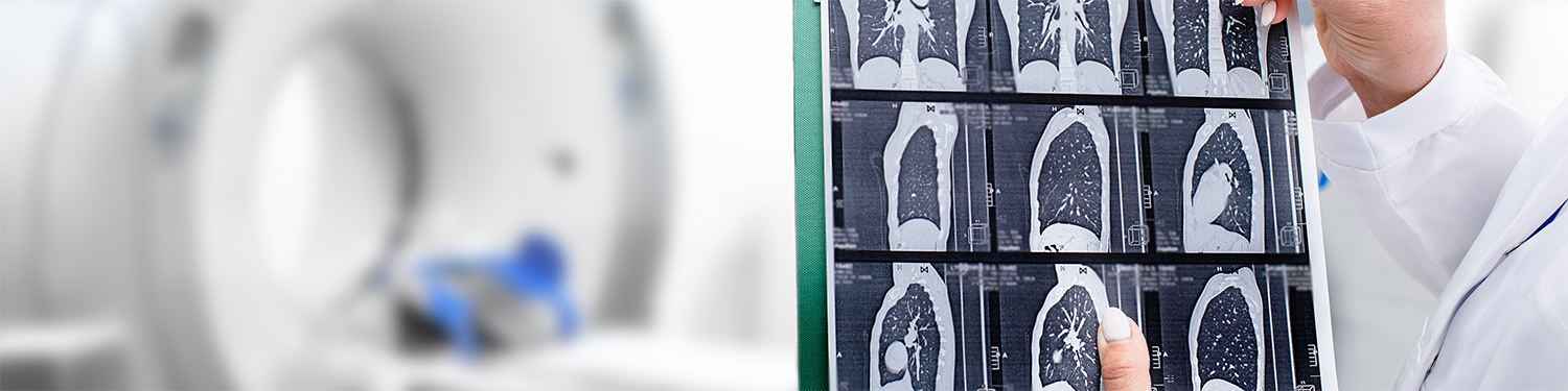 doctor holding lung scan
