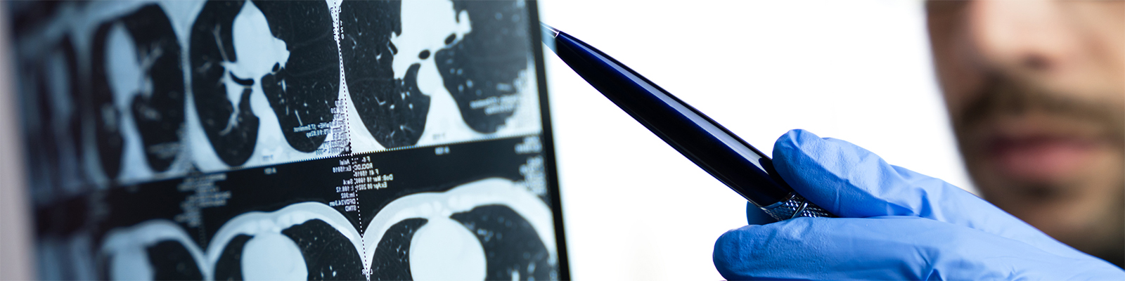 man reviewing scan of lungs